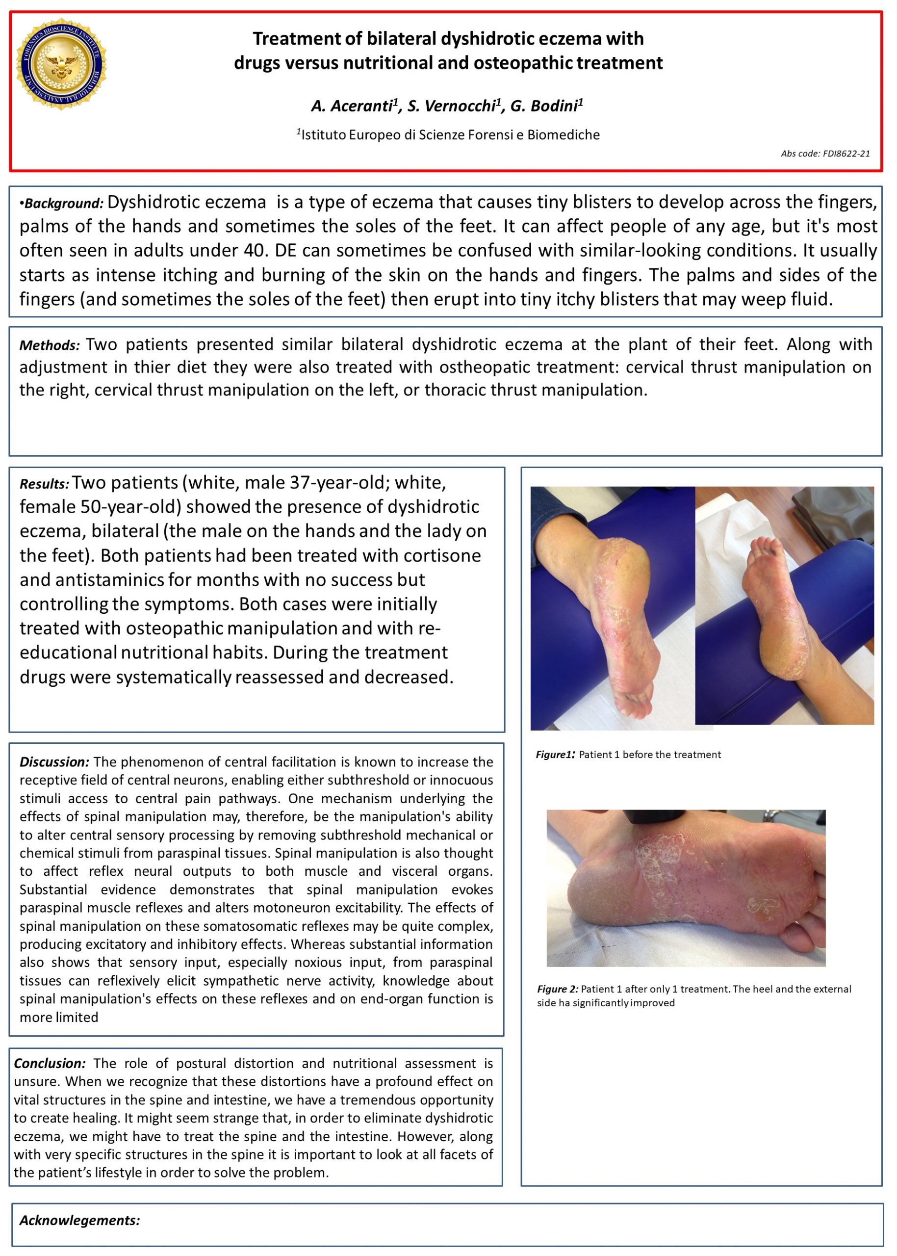 Studio Aceranti | Treatment of bilateral dyshidrotic eczema